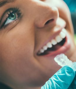Tooth whitening procedure2